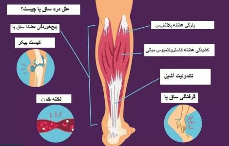 عوامل ایجاد درد ساق پا و راه های درمان آن