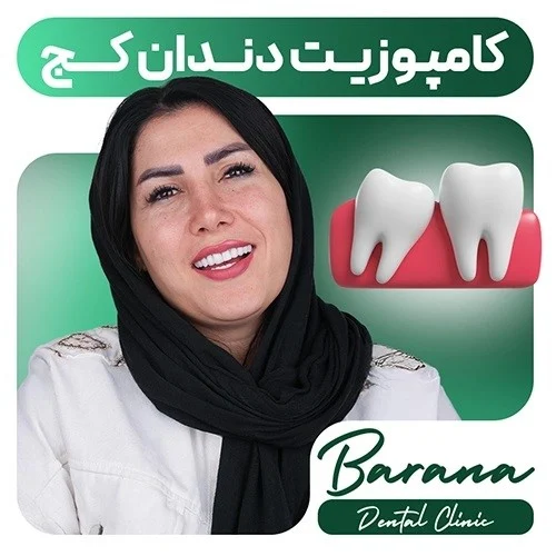 مزایا و معایب کامپوزیت دندان کج