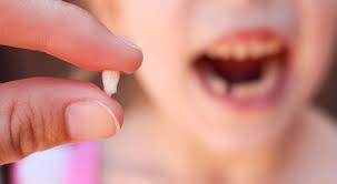 درمان | دندانپزشکی آیا دندان شیری ریشه دارد